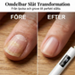 ✨Professionell elektrisk nagelfil——uppgradera din nagelvård med 99 hastigheter & 4 tillbehör ✨💅